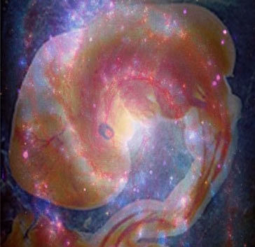galaxyfetus.jpg